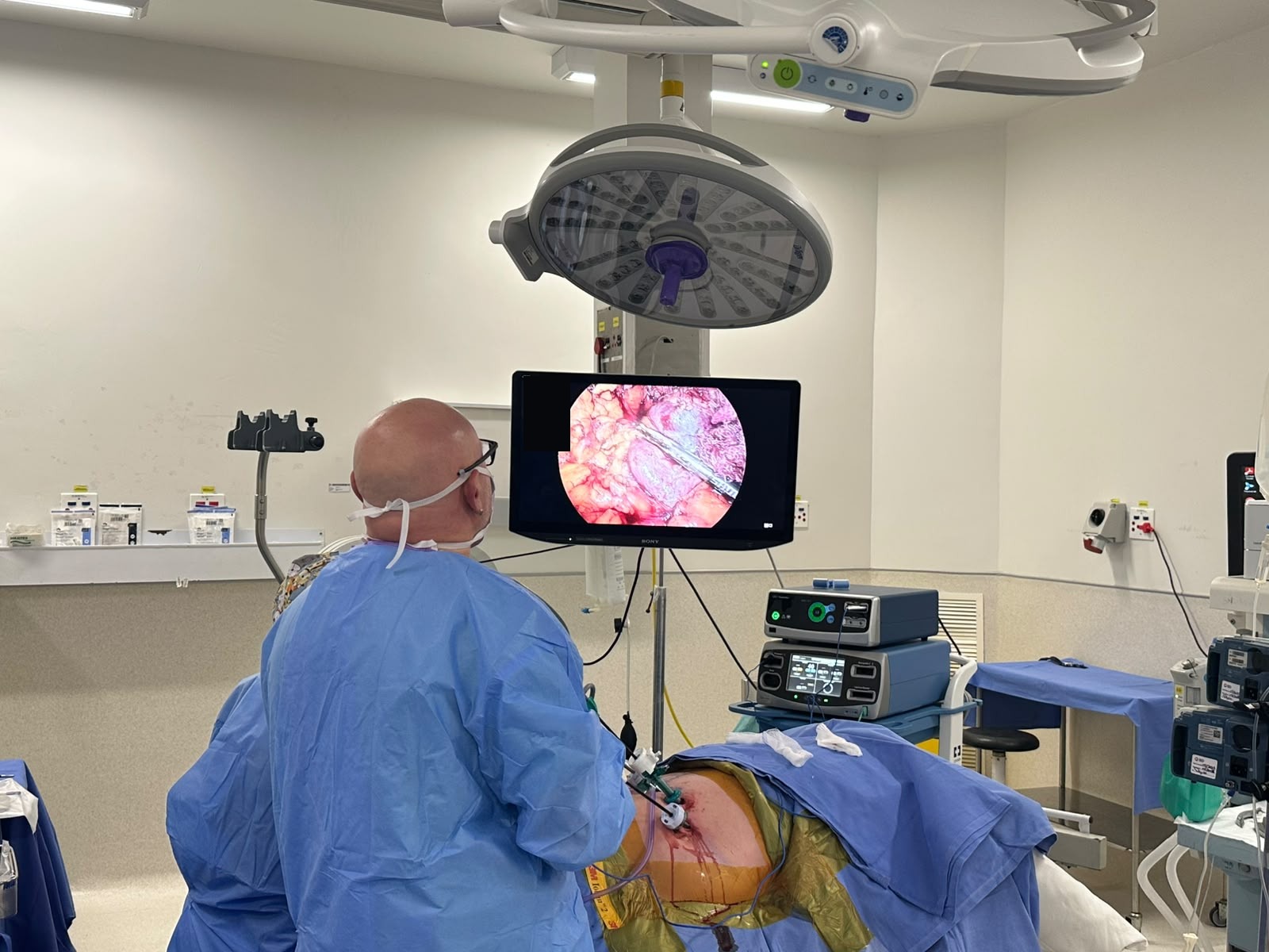 Laparoscopic instruments placed through three small flank ports during adrenal surgery